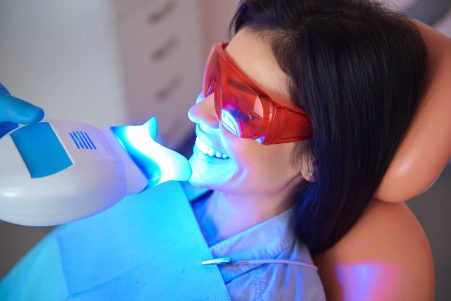 Dental Surgery-Teeth whitening