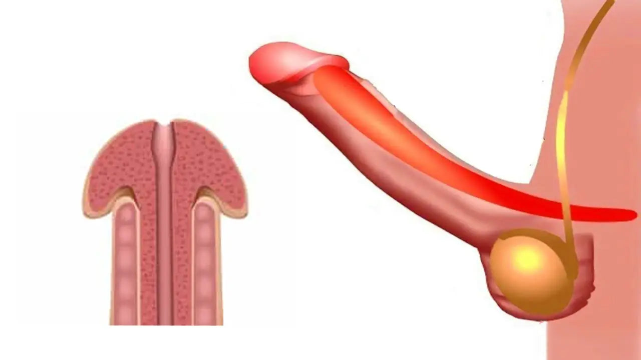 Intimate Surgery-Penile