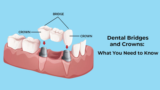 Dental Surgery-Dental crown and bridge