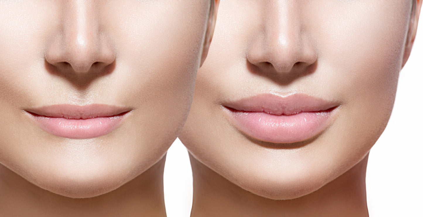 Face Surgery-Lips